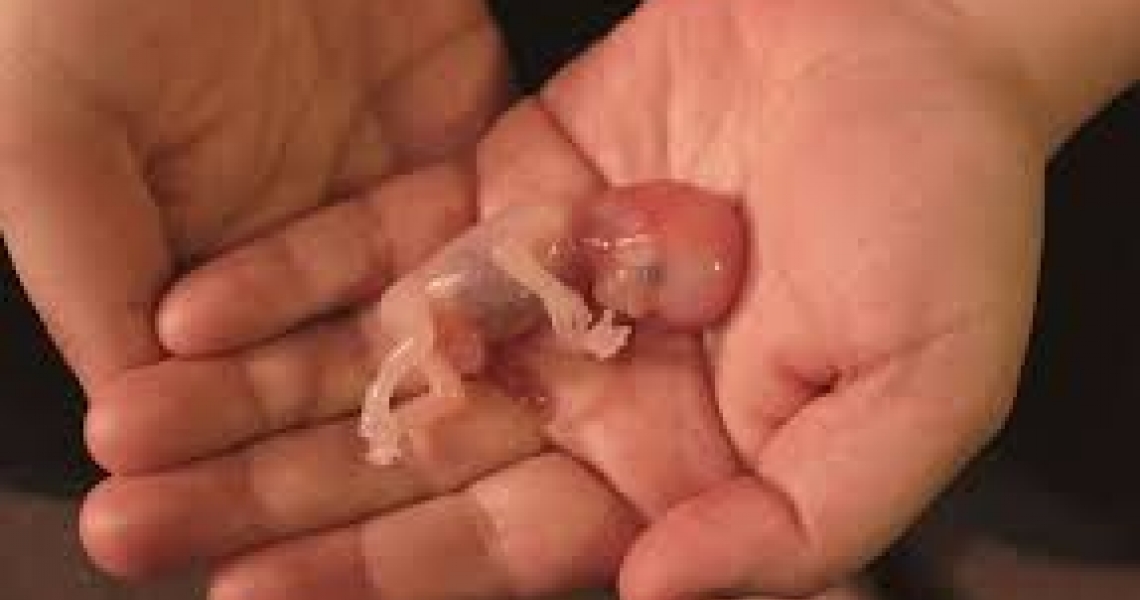 0_aborto1.jpg