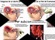 0_aborto14.jpg