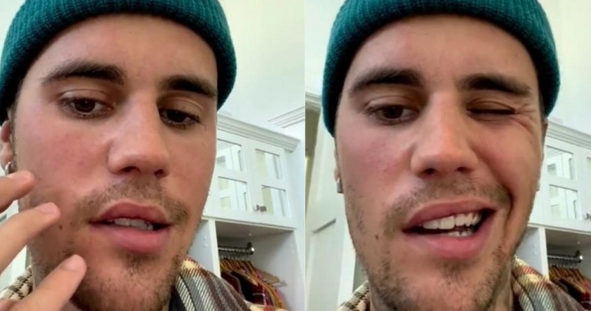 75_tapa-justin.jpg